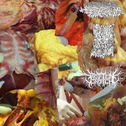 Trabecular Hepatocellular Carcinoma : 3 Way Split